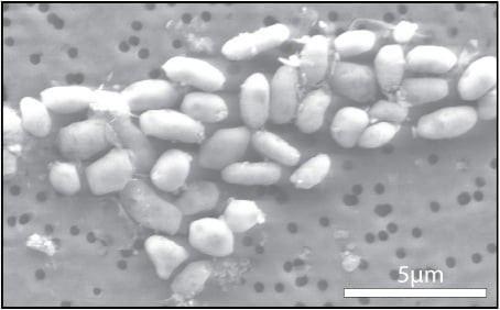 Photo d'une bactérie qui utilise l'arsenic comme source d'énergie