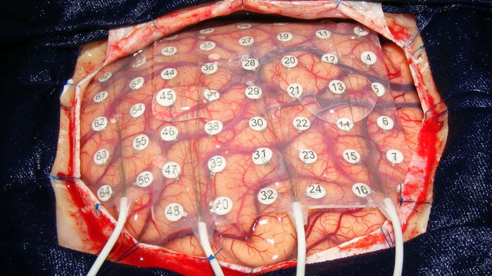Illustration d'un cerveau humain avec des connexions de neurones en arrière-plan